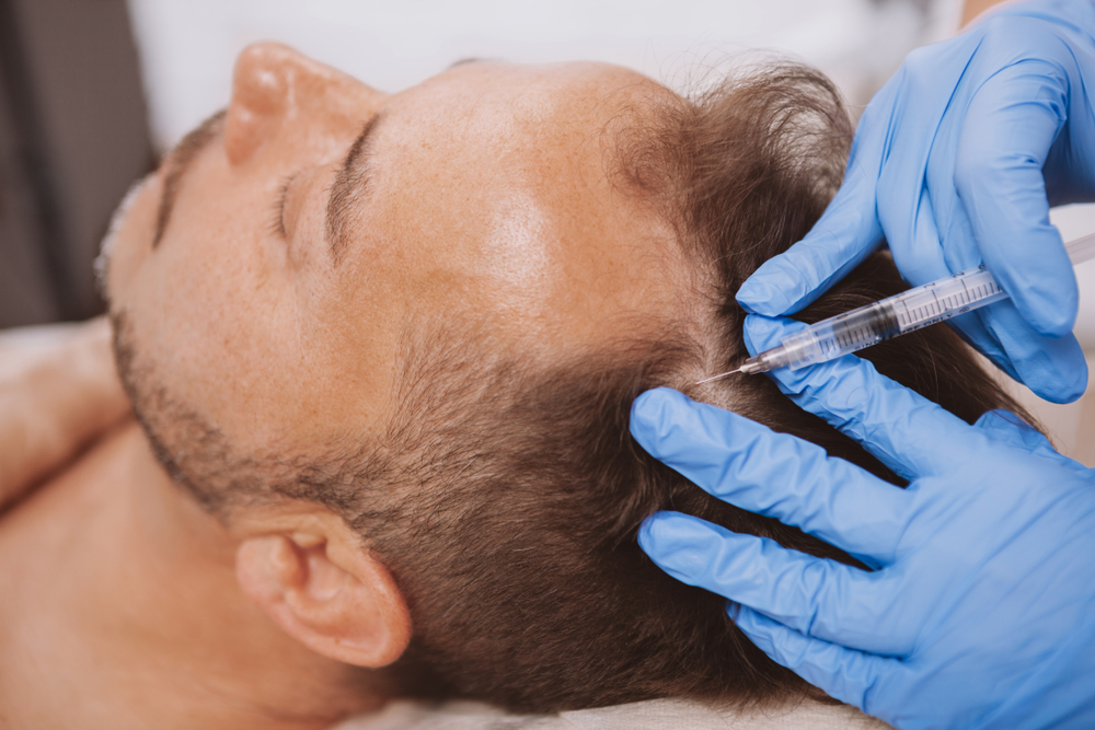 How Long Does PRP Really Last for Hair and Skin Rejuvenation?