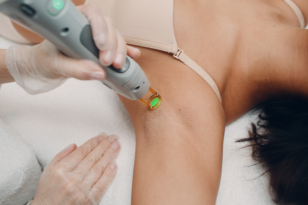How Much Does a Laser Hair Removal Package Cost in College Park?