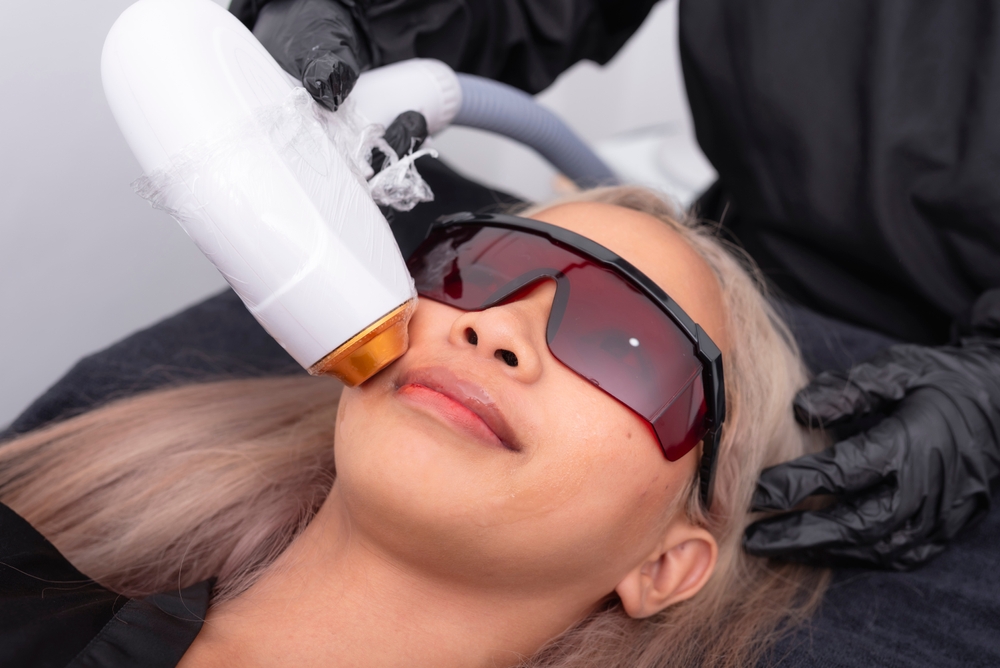 How Many Laser Hair Removal Treatments Are Enough?