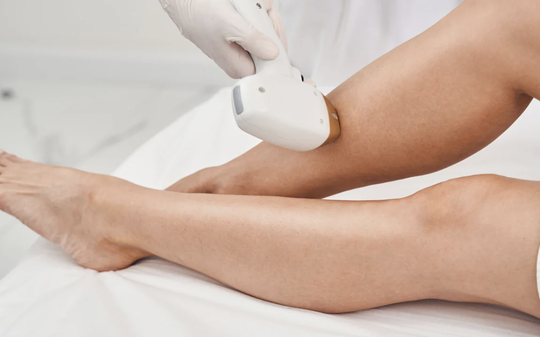 Laser Hair Removal Consultation