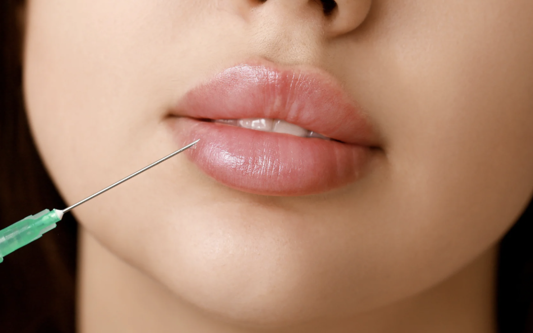 Dermal Filler Injections Near Olney, MD