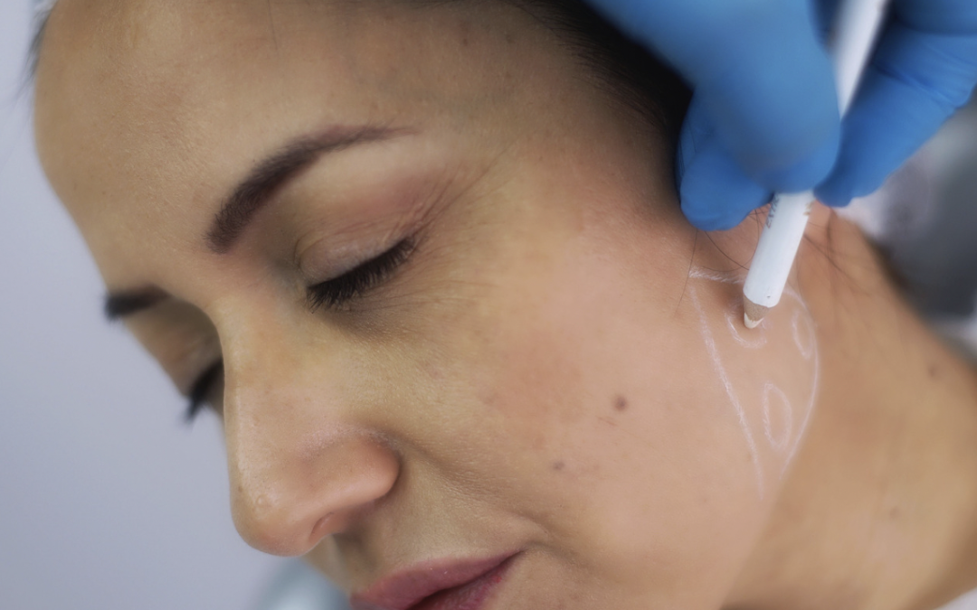 Jawline Contouring Injections Near Olney