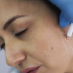 Jawline Contouring Injections Near Olney