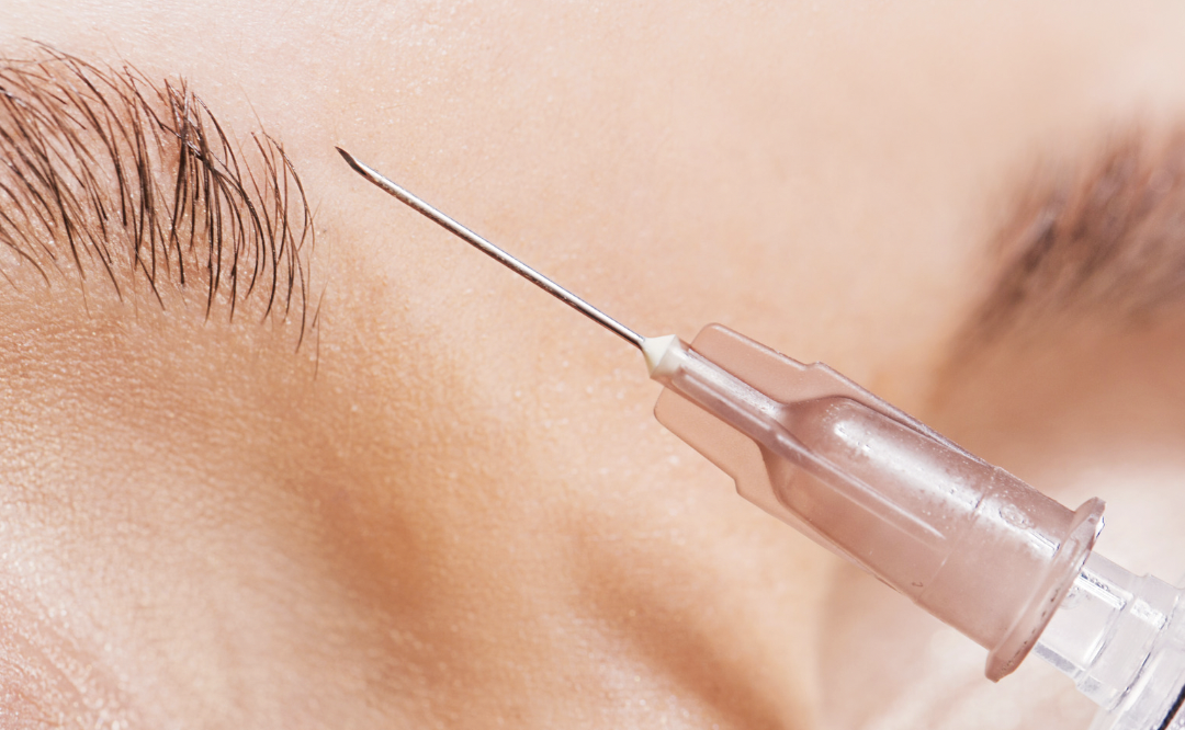 Botox Injectors in Silver Spring