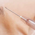 Botox Injectors in Silver Spring