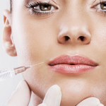 Best Botox Injectors in North Bethesda