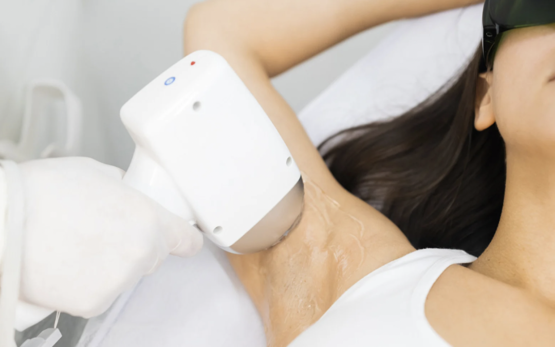 Laser Treatment Costs in Bethesda