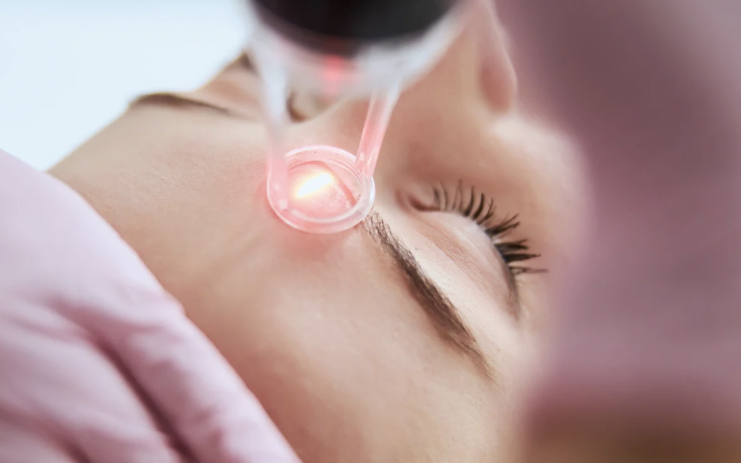 Top Laser Skin Tightening Clinic in Rockville