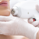 New Innovative Laser Hair Removal Options