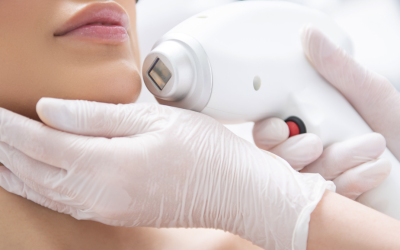 Why Montgomery County Residents Are Choosing New Innovative Laser Hair Removal Options