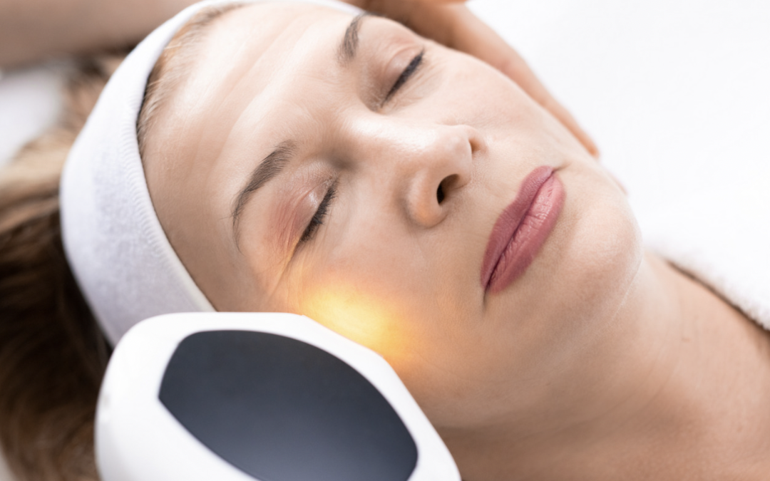 Laser Resurfacing Rejuvenates the Skin for Rockville