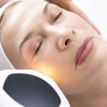 Laser Resurfacing Rejuvenates the Skin for Rockville