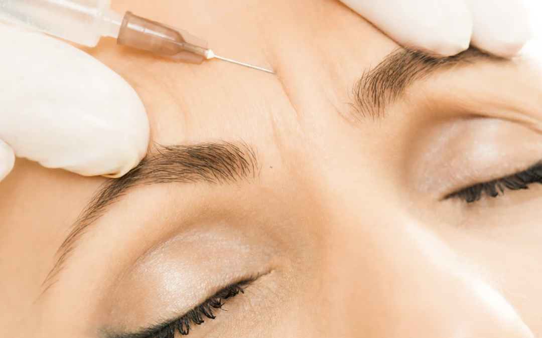 Botox Unit Costs Near Rockville MD