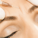 Botox Unit Costs Near Rockville MD