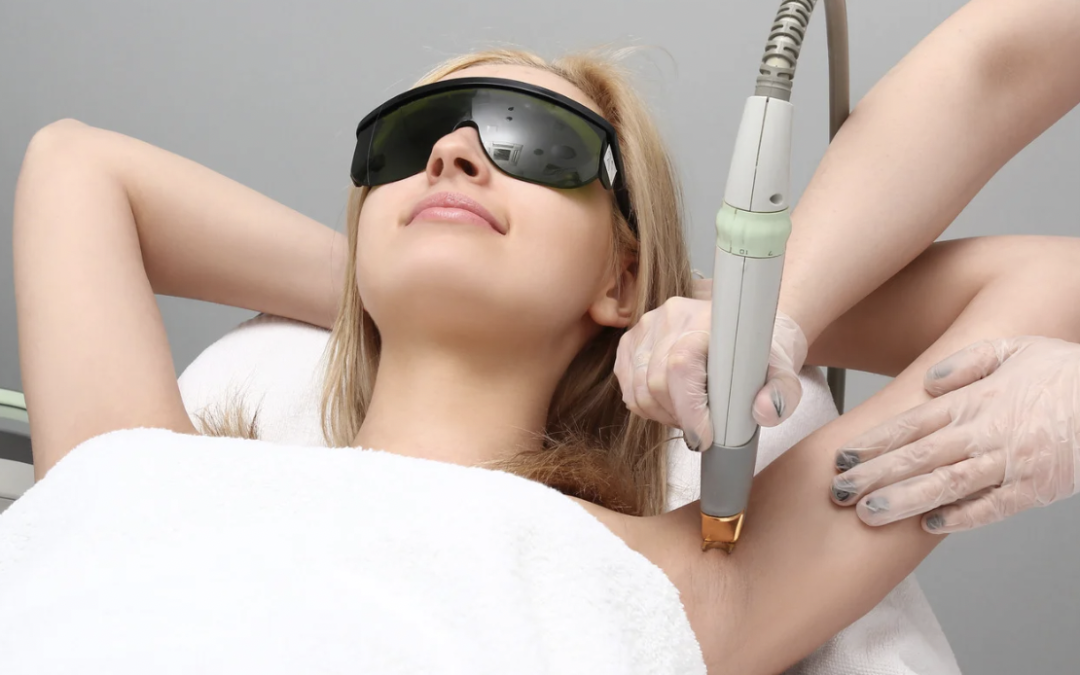 How to Find the Top Provider in Montgomery County MD for Painless Laser Hair Removal
