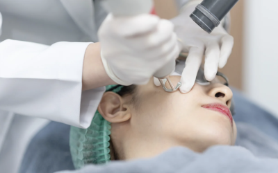 Exploring How Laser Skin Tightening Works in Potomac, Maryland