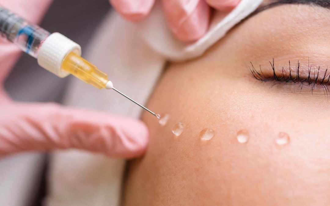 Under-Eye Filler Appointment for Dark Circles Near Chevy Chase, MD