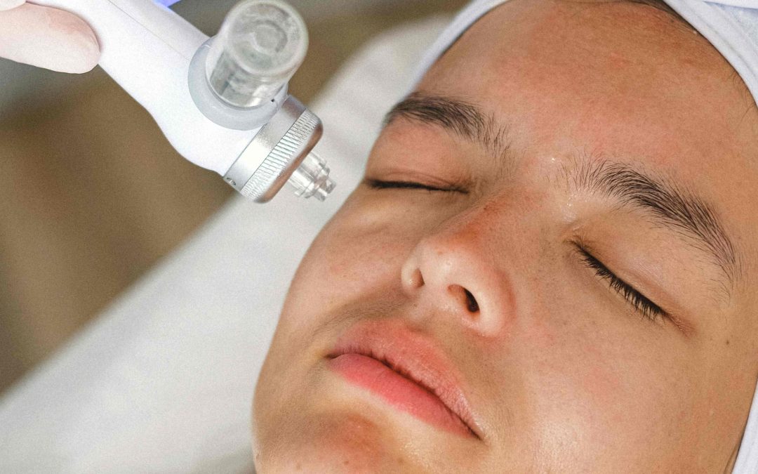 Laser Skin Tightening and Wrinkle Reduction Near North Bethesda, MD