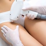 Brazilian Laser Hair Removal in North Bethesda Maryland