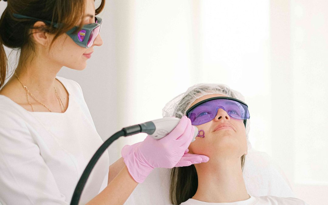 Laser Treatments for Sun Damage and Age Spots in Potomac, Maryland