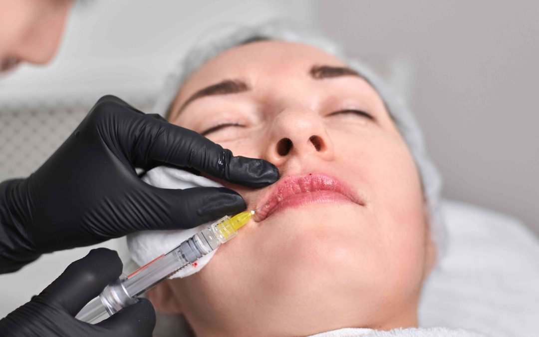 Lip Filler and Facial Balancing in North Potomac Maryland