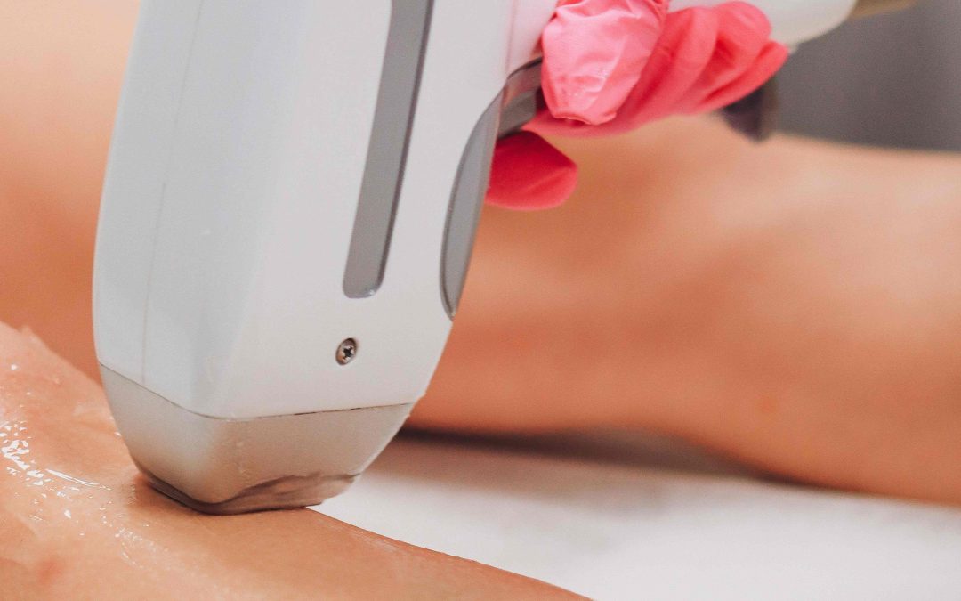 Laser Hair Removal Services in Bethesda, Maryland