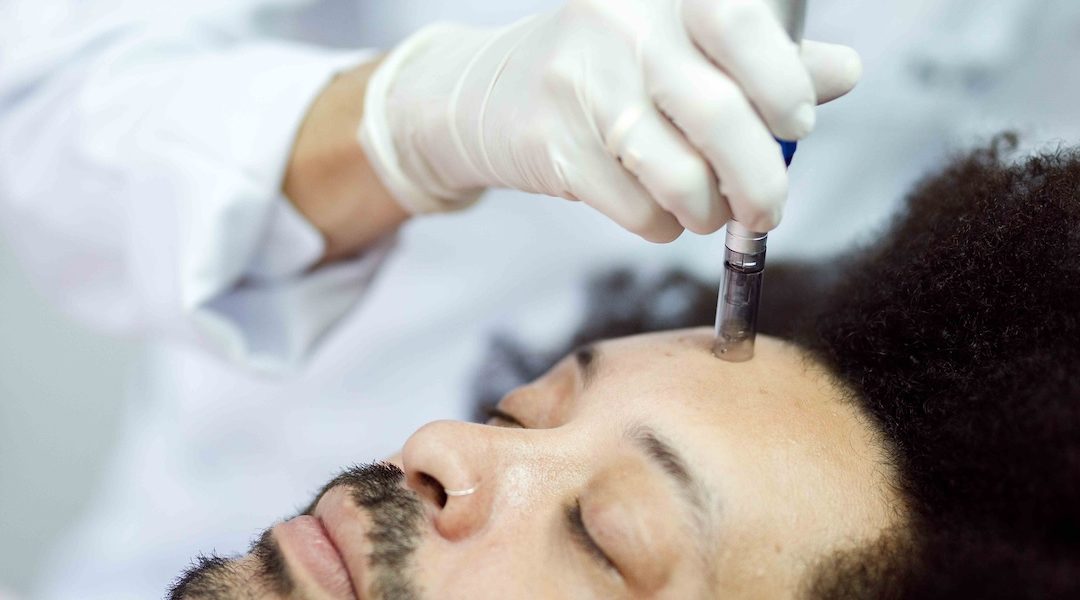 Radiofrequency Microneedling Skin Tightening Pricing in Chevy Chase, MD