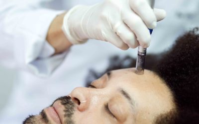 Radiofrequency Microneedling Skin Tightening Pricing in Chevy Chase, MD