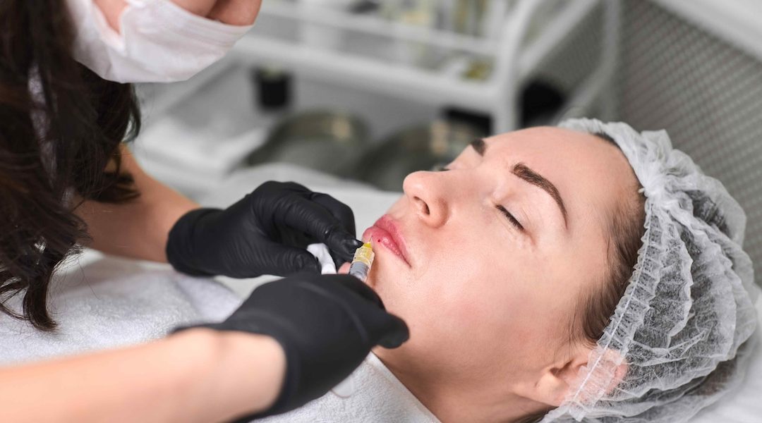 Quick Guide to Juvéderm Lip Filler Pricing in Potomac, MD
