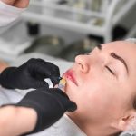 Juvéderm Lip Filler Pricing in Potomac MD