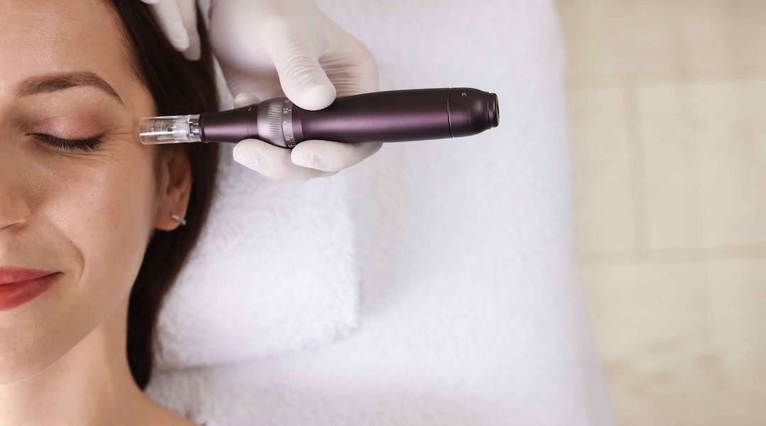 Microneedling Cost Per Session in Chevy Chase, MD