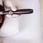 Microneedling Cost Per Session in Chevy Chase MD