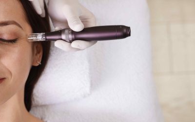 Microneedling Cost Per Session in Chevy Chase, MD