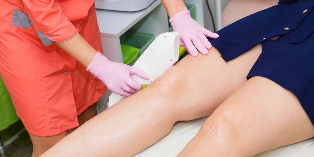 Guide to Laser Hair Removal Cost for Full Body in Bethesda, MD
