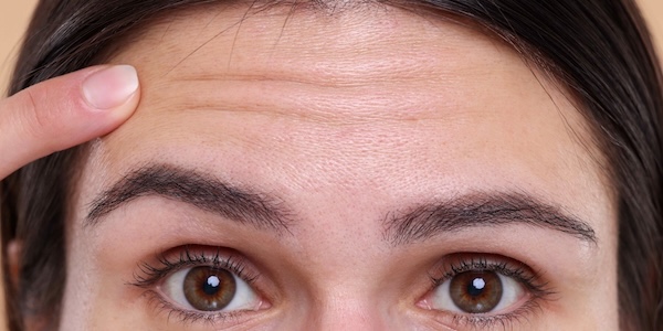 Preventative Botox for Forehead Lines in Potomac, MD Cost