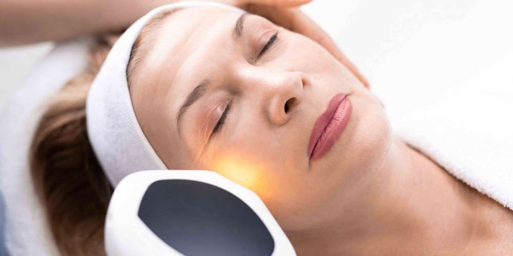 Laser Treatment for Acne Scars Near Gaithersburg MD