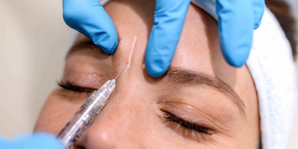 Preventative Botox in Chevy Chase MD