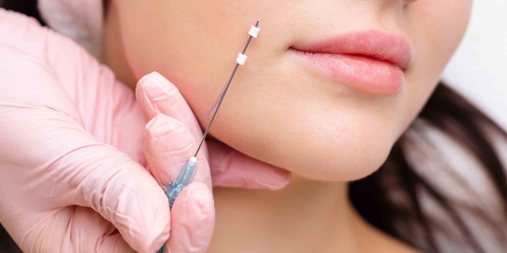 Thread Lift in Bethesda, MD: Why Results May Not Last