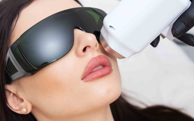 Laser Hair Removal Face Pricing in Potomac, MD