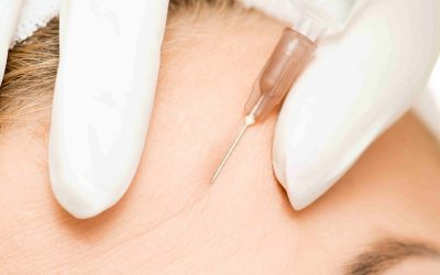 Botox Near Bethesda, MD: What to Ask Before Treatment