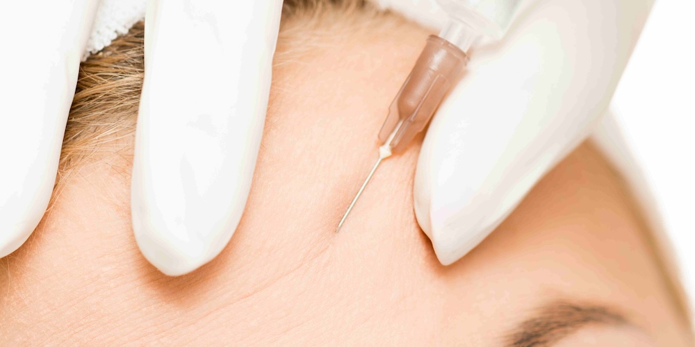 Botox Near Bethesda, MD: What to Ask Before Treatment