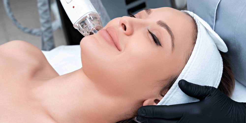 IPL vs Laser Treatments Near North Potomac, MD