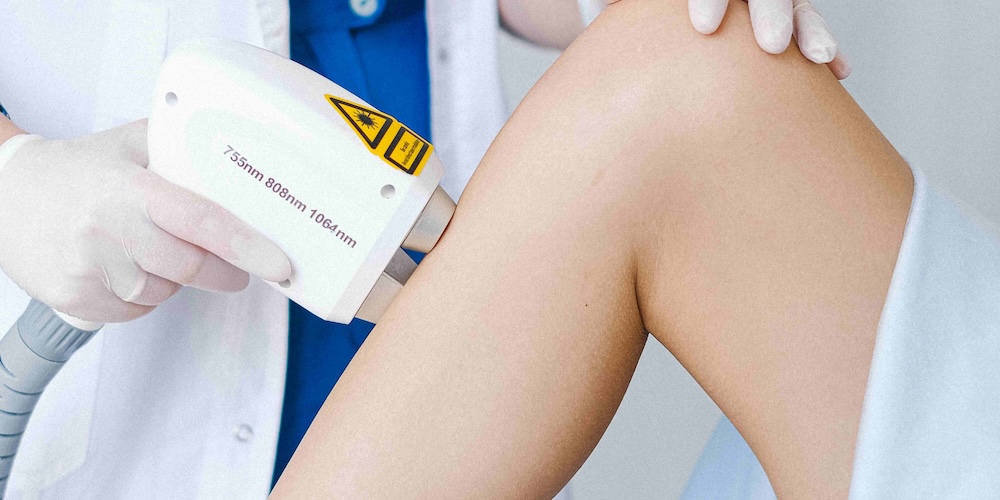 Laser Hair Removal Maintenance Near Chevy Chase, MD