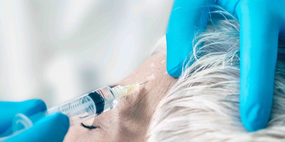 How Long Will My Botox Last and What Affects Results