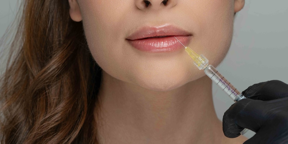 Lip Filler Explained: Benefits Risks and What to Expect