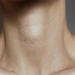 Non-Surgical Neck Tightening Treatments in Rockville Maryland