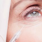 Under Eye Filler Treatments for Tired Eyes in Rockville Maryland