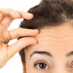 Best Botox Injector in Potomac Maryland