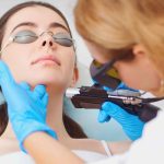 Laser Skin Treatment Near North Bethesda Maryland