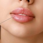 Lip Filler Consultation in North Potomac MD